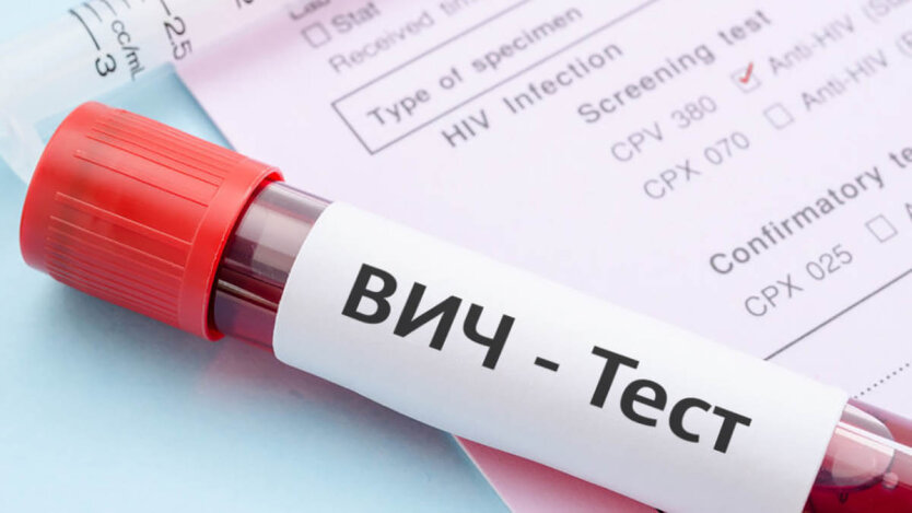 Russia worsened the situation with HIV